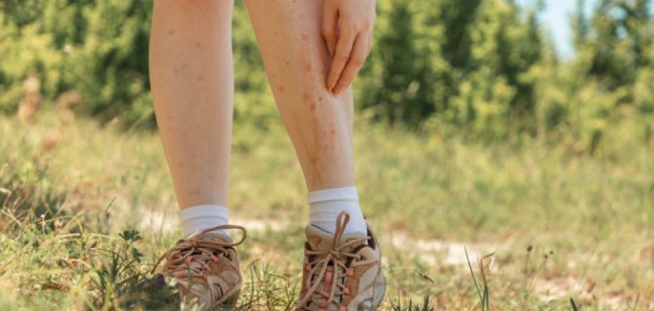 Eine Frau mit kurzer Hose steht auf einer Wiese und kratzt sich an den Beinen